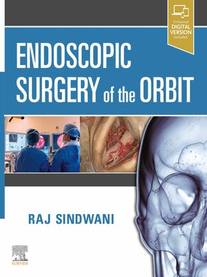 cover image of Endoscopic Surgery of the Orbit E-Book